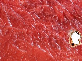 L’odontoiatria e le reazioni avverse a farmaci associate a disturbi delle ghiandole salivari e alterazioni della funzione gustativa