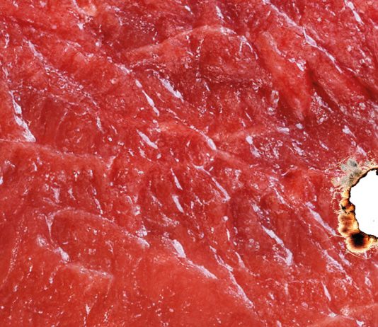 L’odontoiatria e le reazioni avverse a farmaci associate a disturbi delle ghiandole salivari e alterazioni della funzione gustativa