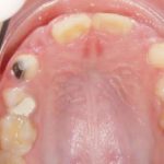 Fig. 8 Fotografia intra orale occlusale.