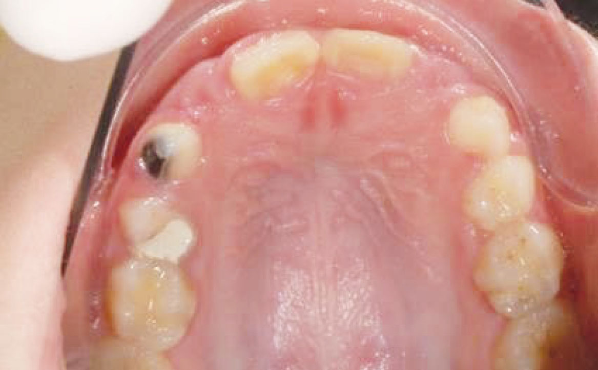 Fig. 8 Fotografia intra orale occlusale.