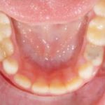 Fig. 9 Fotografia intra orale occlusale.