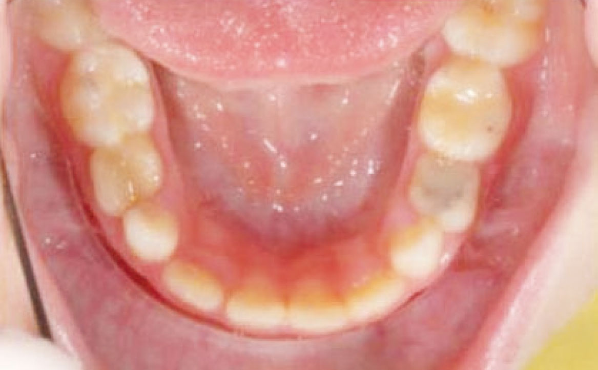 Fig. 9 Fotografia intra orale occlusale.