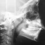 Fig. 11 Teleradiografia latero-laterale.