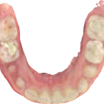 Fig. 7B Modello digitale dell’arcata inferiore.