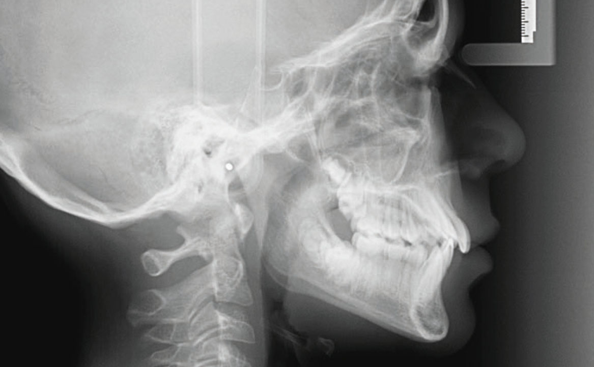 Fig. 6 Ortopantomografia.