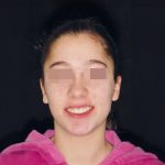 Fig. 21 Fotografia extra orale finale: frontale col sorriso.