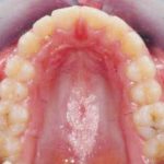 Fig. 26 Fotografia intra orale occlusale finale.