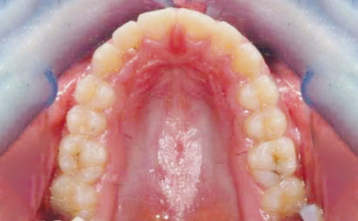 Fig. 26 Fotografia intra orale occlusale finale.