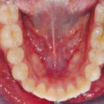 Fig. 27 Fotografia intra orale occlusale finale.