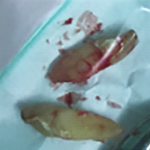 Fig. 3 Dettaglio dei denti estratti.