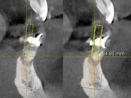 Fig. 6 Progettazione tridimensionale degli impianti.
