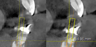 Fig. 6 Progettazione tridimensionale degli impianti.