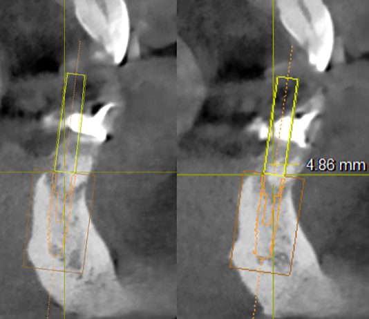 Fig. 6 Progettazione tridimensionale degli impianti.