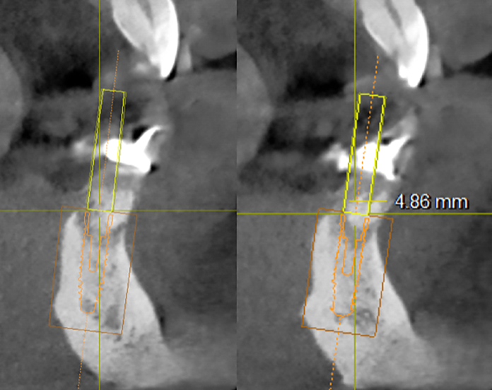 Fig. 6 Progettazione tridimensionale degli impianti. Fig. 6 Progettazione tridimensionale degli impianti.