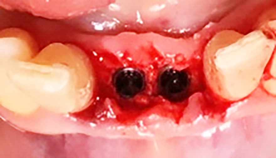 Fig. 9 Posizionamento degli impianti.