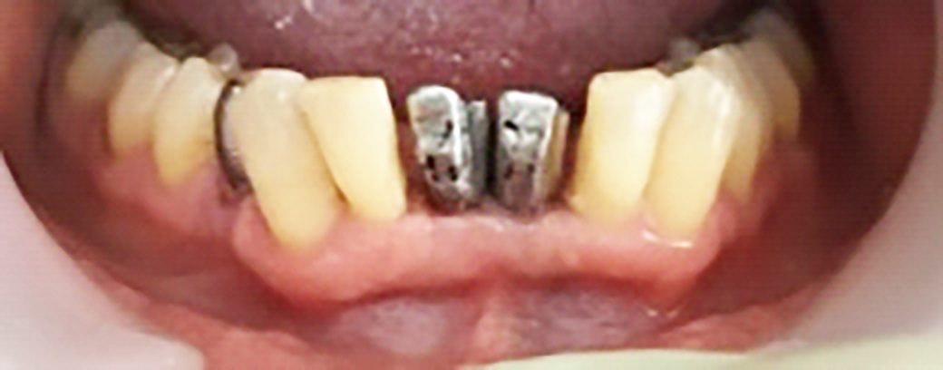 Fig. 13 Prova struttura definitiva.