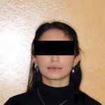 Fig. 1A Foto frontale a riposo.
