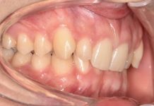 Fig. 1A Fotografia intraorale iniziale.