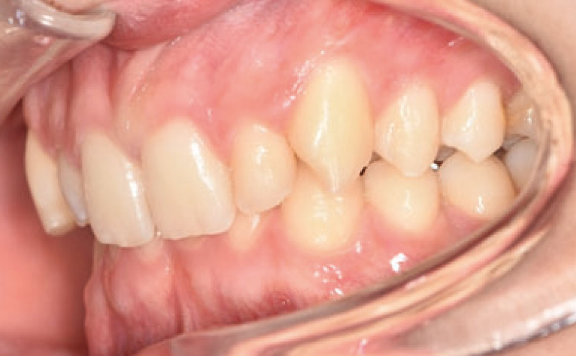 Fig. 1C Fotografia intraorale iniziale.