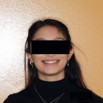 Fig. 1B Foto frontale con sorriso.