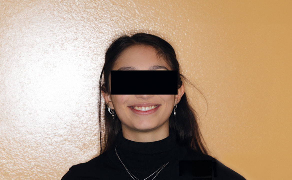 Fig. 1B Foto frontale con sorriso.