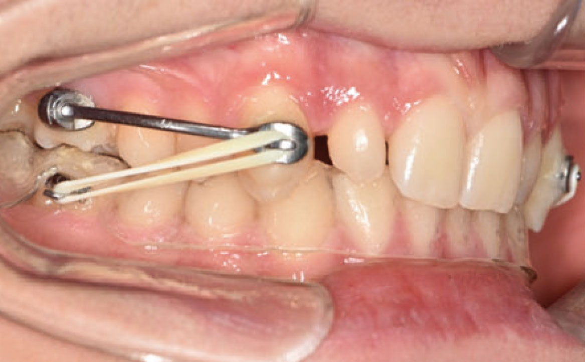 Fig. 3A Primo check-up.