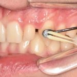 Fig. 3C Primo check-up.