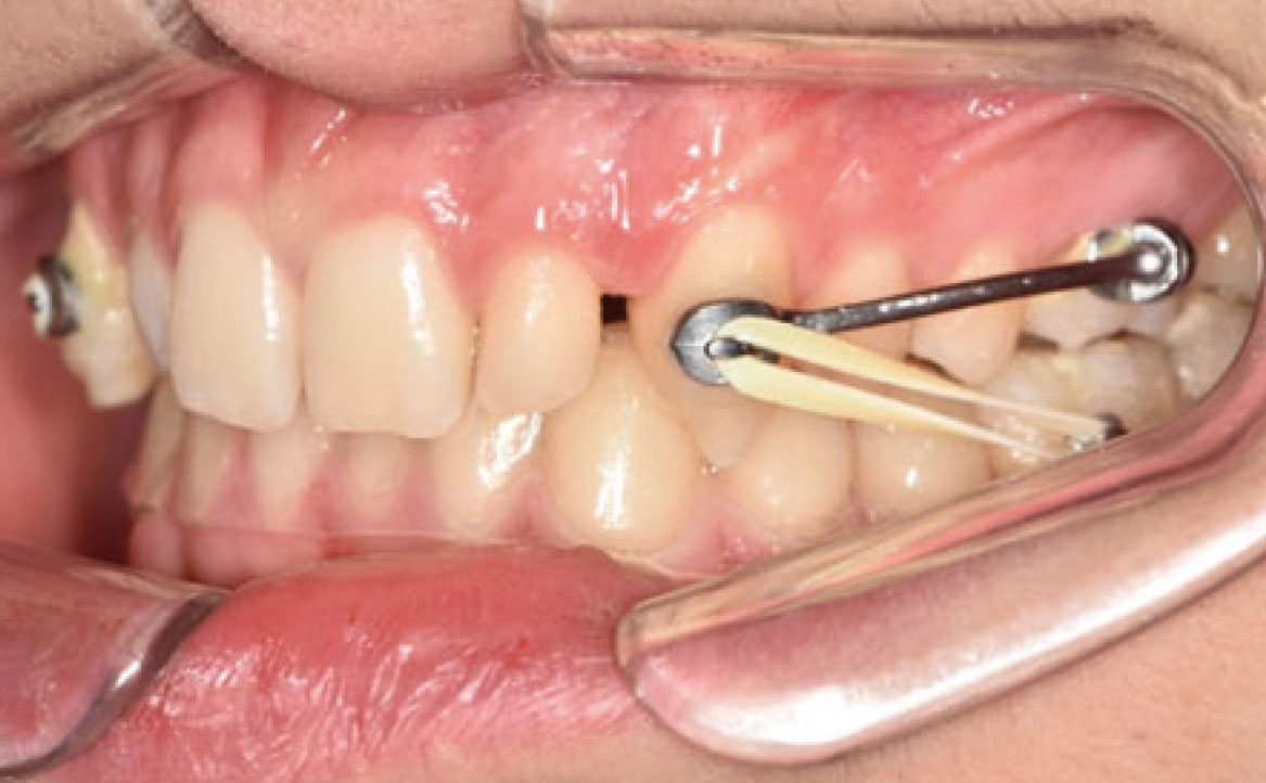Fig. 3C Primo check-up.