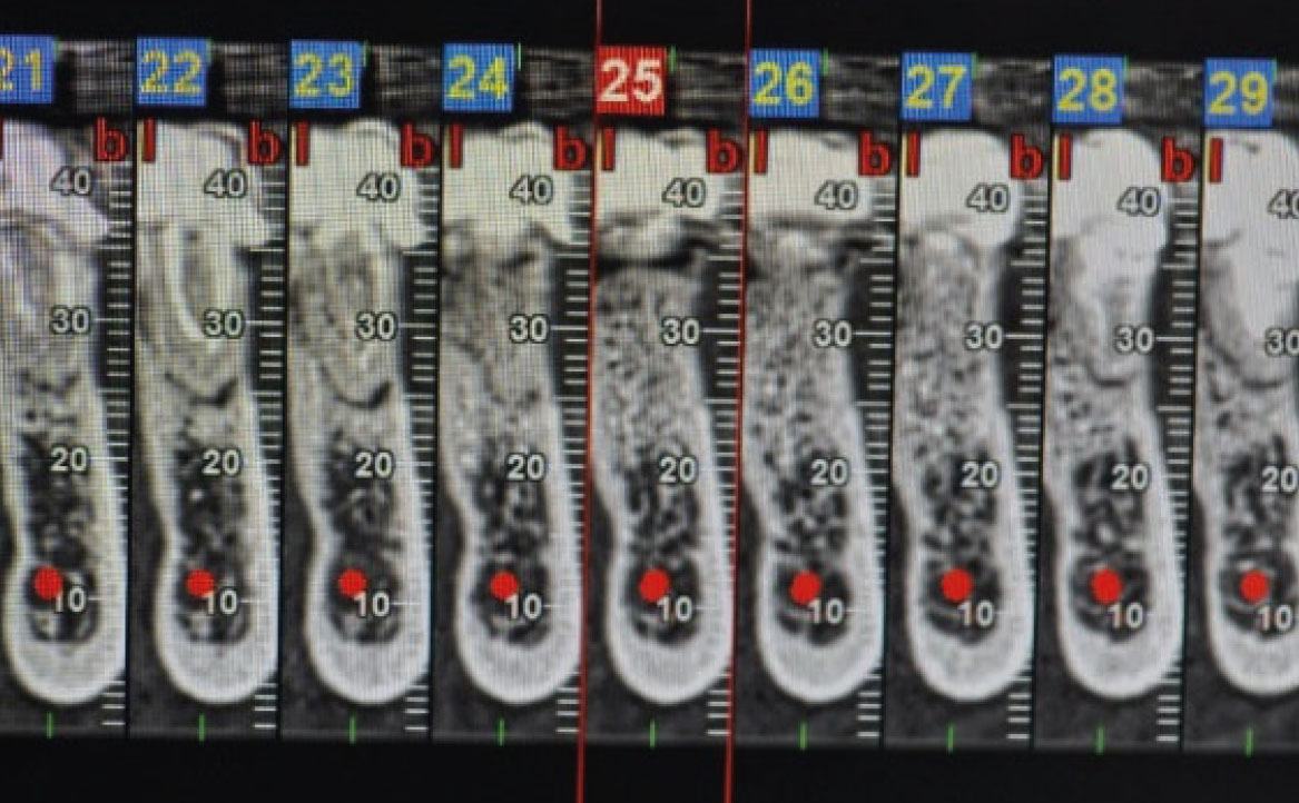 Fig. 4 Cross section.