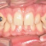 Fig. 4B Secondo check-up.
