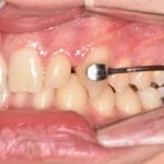 Fig. 4C Secondo check-up.