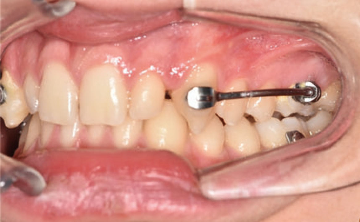 Fig. 4C Secondo check-up.