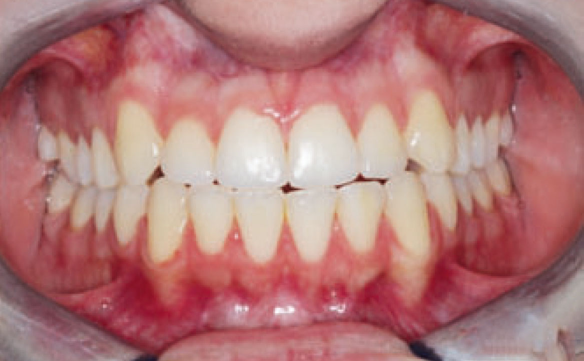 Fig. 2B Foto frontale.