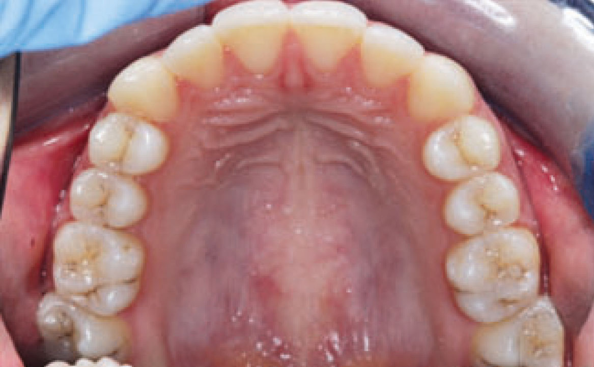 Fig. 2E Foto arcata superiore.