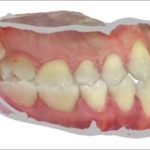 Fig. 3A Scansione intraorale: foto laterale di destra.