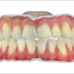 Fig. 3B Scansione intraorale: foto frontale.