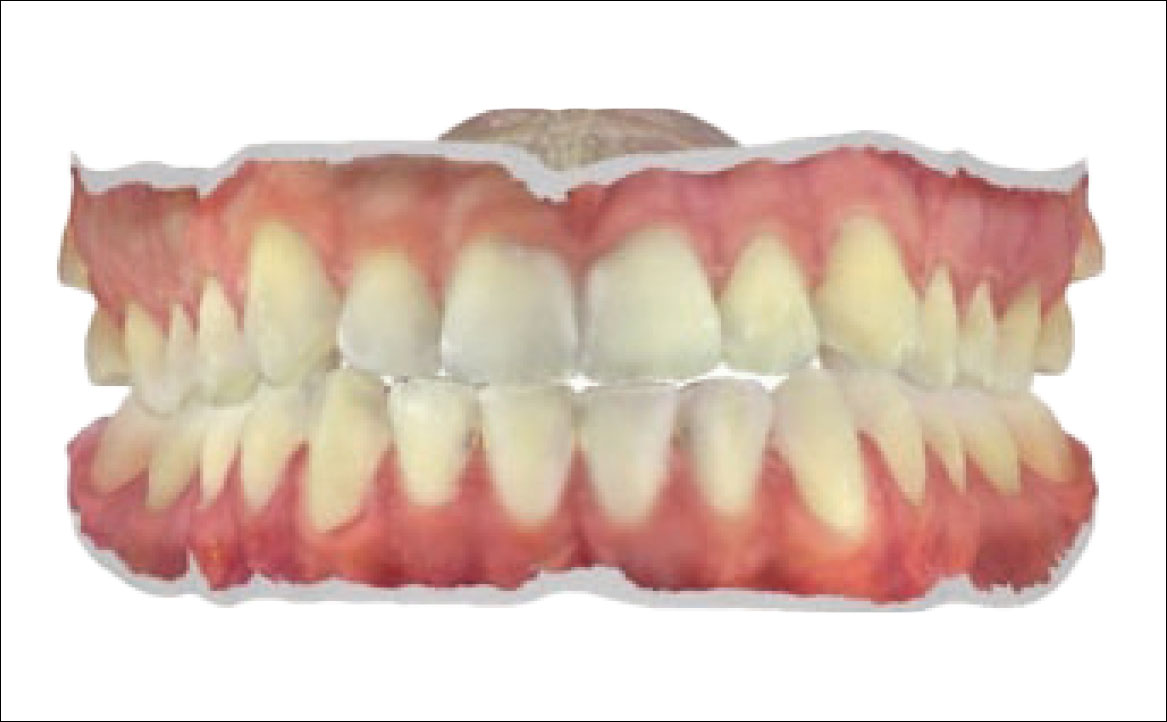 Fig. 3B Scansione intraorale: foto frontale.