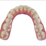 Fig. 3D Scansione intraorale: foto arcata inferiore.
