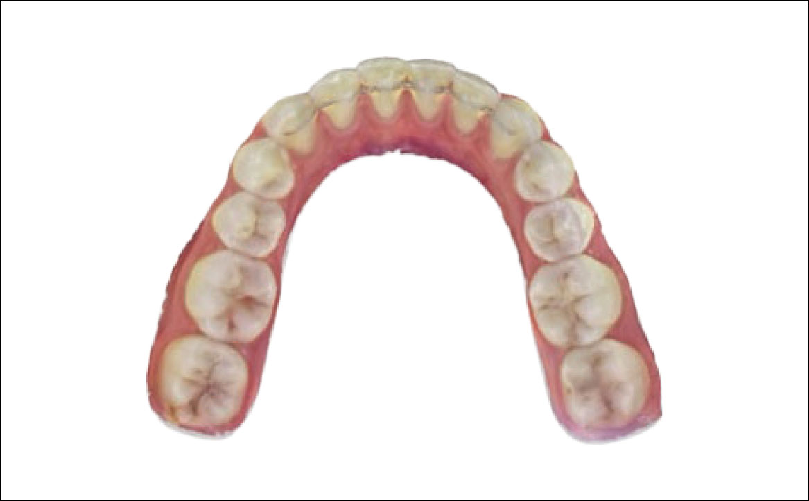 Fig. 3D Scansione intraorale: foto arcata inferiore.