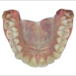 Fig. 3E Scansione intraorale: foto arcata superiore.