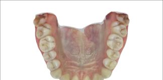 Fig. 3E Scansione intraorale: foto arcata superiore.