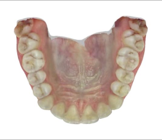 Fig. 3E Scansione intraorale: foto arcata superiore.