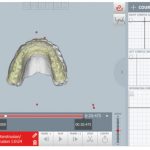 Fig. 4C Registrazione cinematica mandibolare durante i movimenti di apertura.