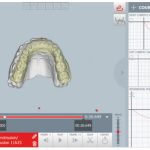 Fig. 4D Registrazione cinematica mandibolare durante i movimenti di apertura.