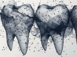 Intelligenza artificiale in odontoiatria: applicazione, prospettive e sfide per una rivoluzione digitale