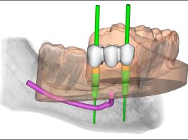 Progettazione virtuale.