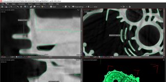 CT scans in only 50 seconds