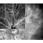 Angiography_01