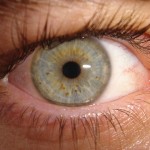 congiuntiviti_allergiche