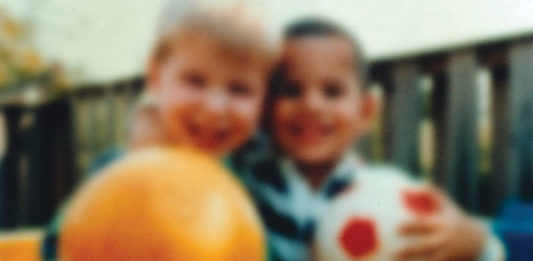 Progressione della cataratta nucleare, fattori genetici e dietetici che l’influenzano cataratta nucleare